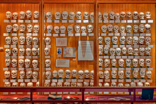 Photo courtesy of MutterMuseum.org